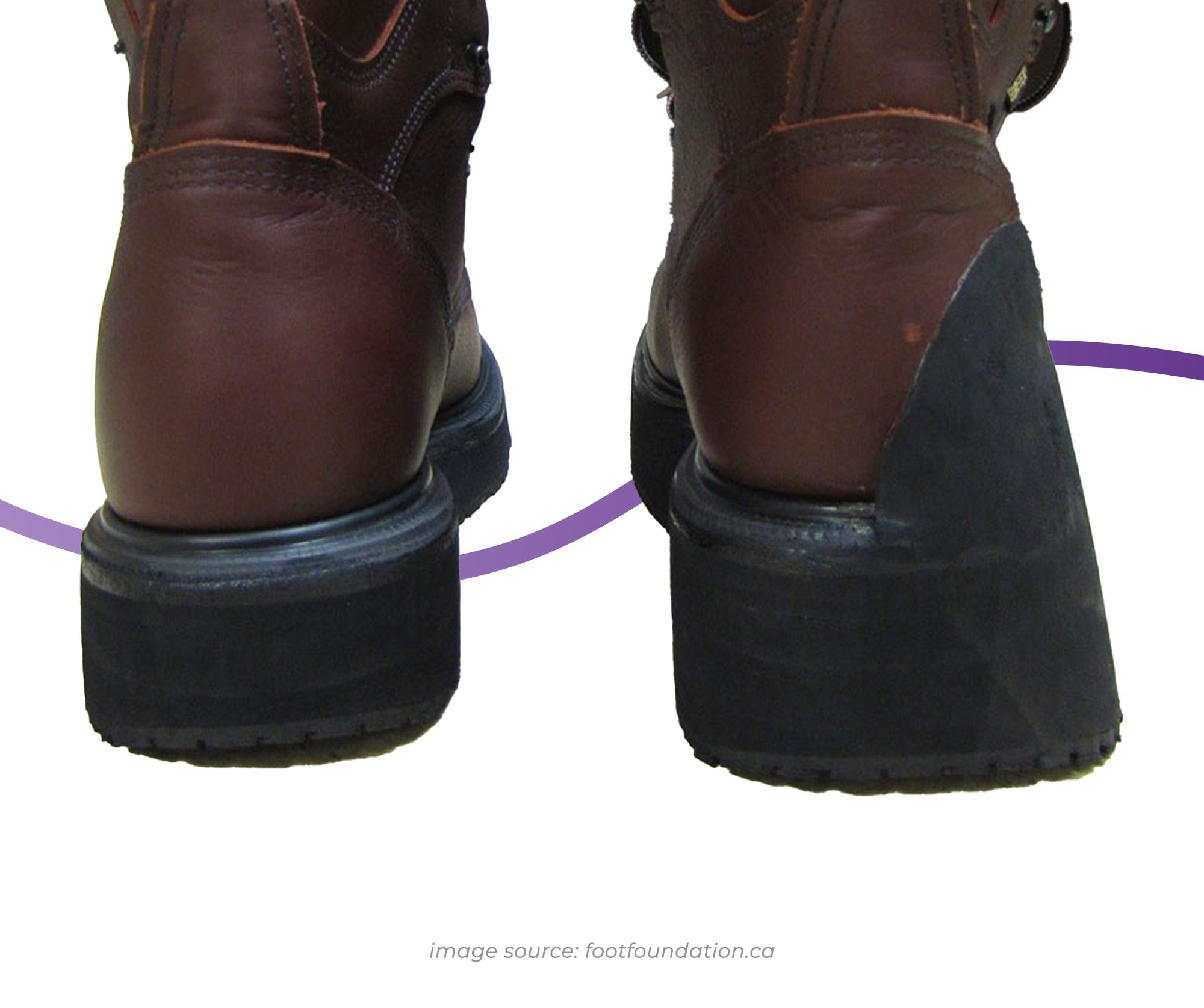 Footwear Modifications The Feet People Podiatry