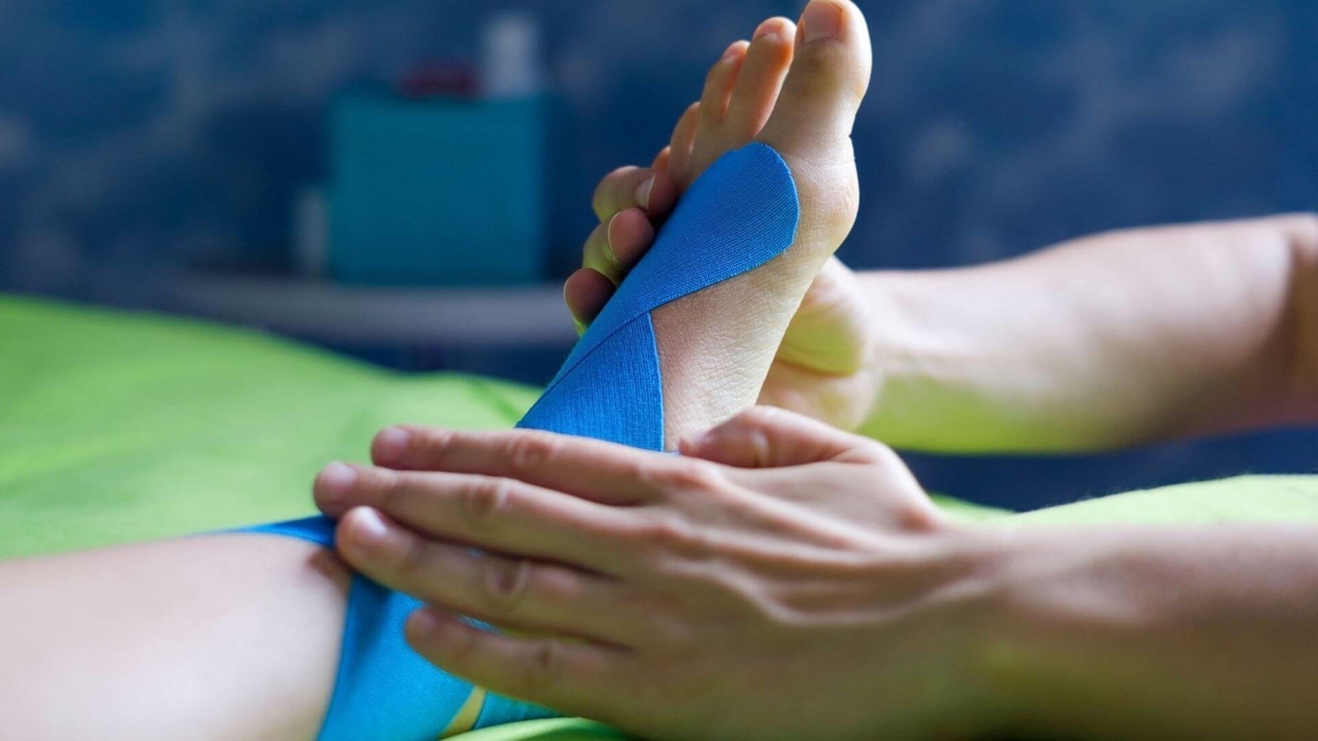 A close up of a blue goved hand placing a thin needle into the skin as part of a dry needling session