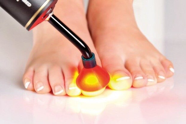 Shockwave Therapy Brisbane - Plantar Fasciitis Treatment