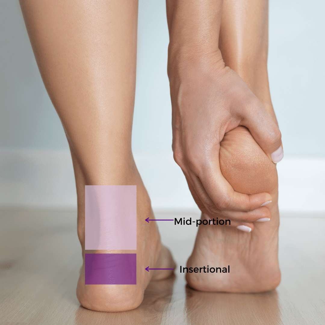 Different types of Achilles tendinopathy Back of two feet and ankles with a hand clutching one heel. Two shaded areas show the locations of two different Achilles tendinopathy conditions