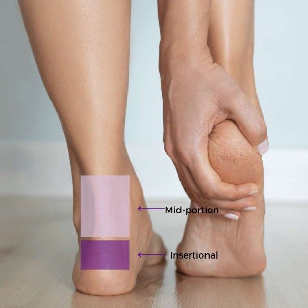 Back of two feet and ankles with a hand clutching one heel. Two shaded areas show the locations of two different Achilles tendinopathy conditions