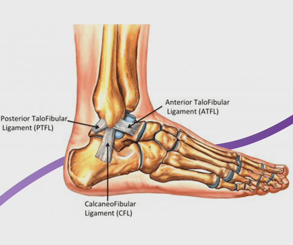 Ankle Sprains: Causes, Symptoms & Treatment