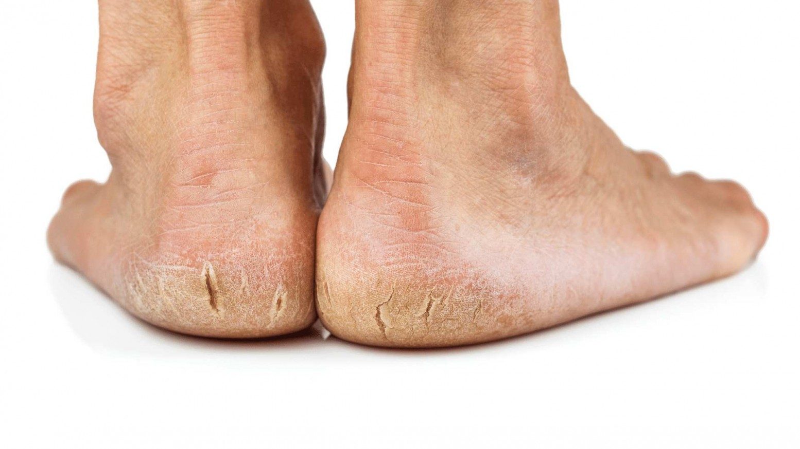 Nerve Pain in Your Feet | Sol Foot & Ankle Centers