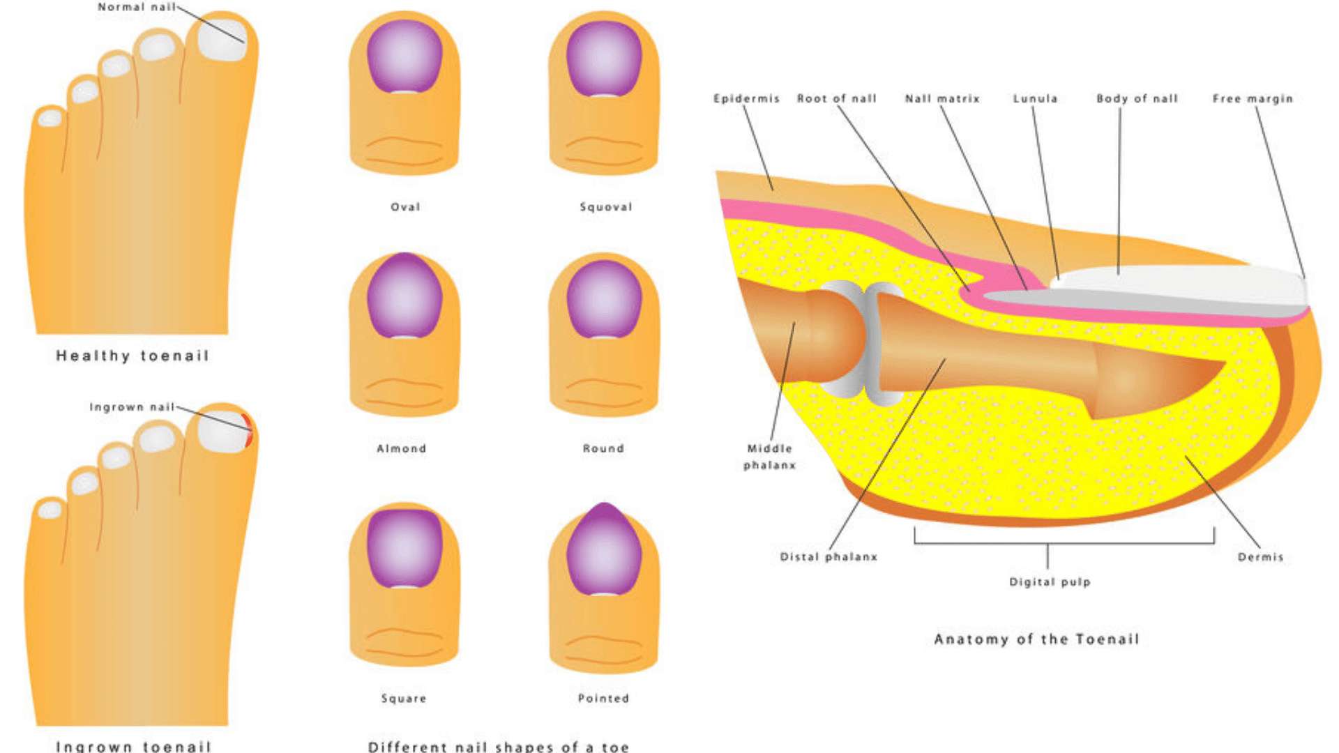 A diagram showing the different shapes of people's nails and the nail matrix