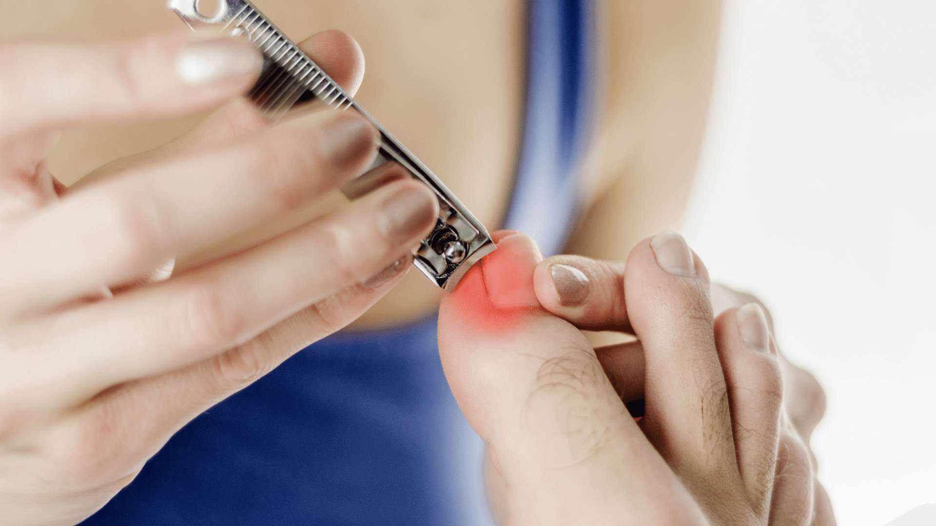 A close up of a woman cutting the nail of a big toe on someone's foot. A red highlighted area indicates pain.