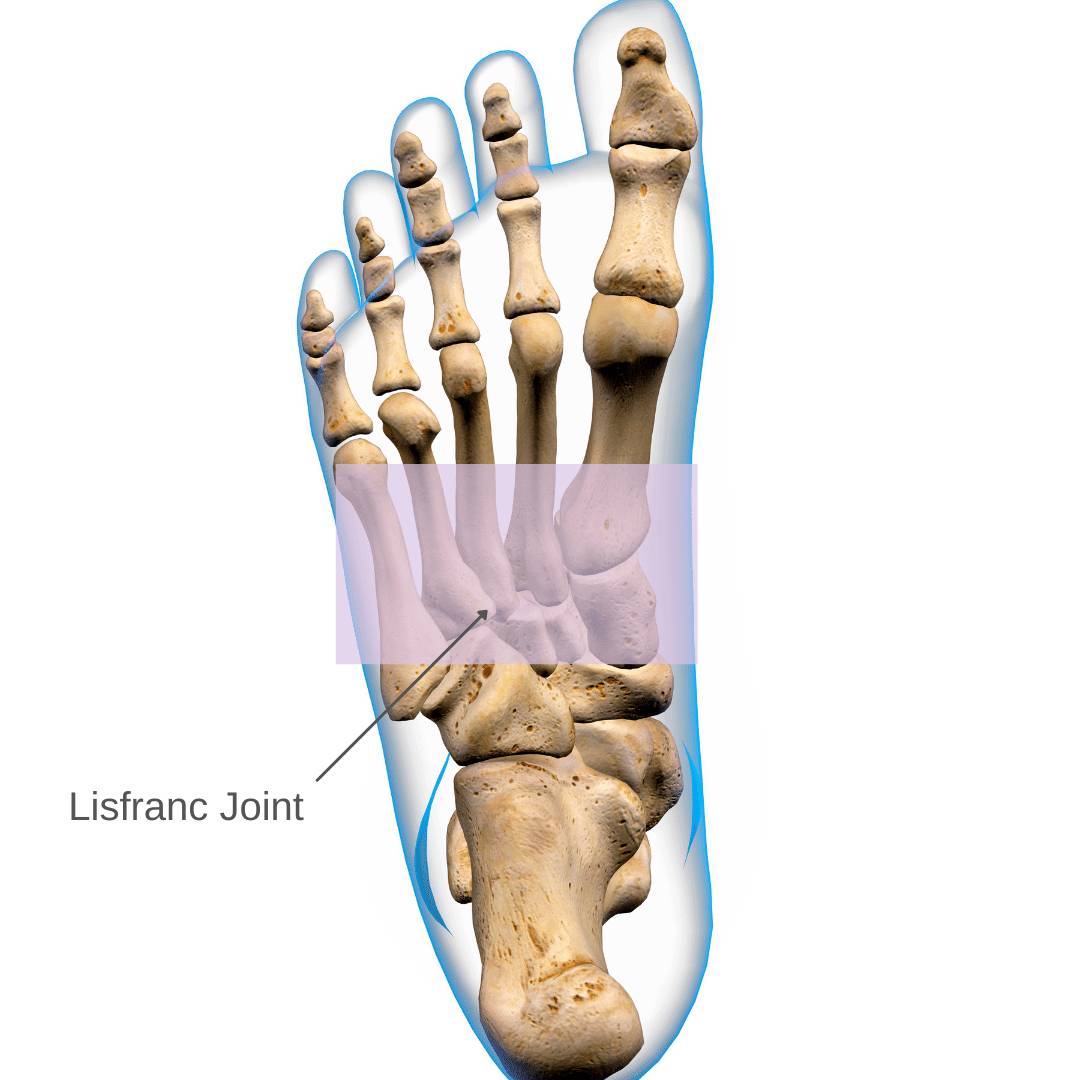 A top down view of the foot bones with a shaded purple area showing where the Lisfranc joint is