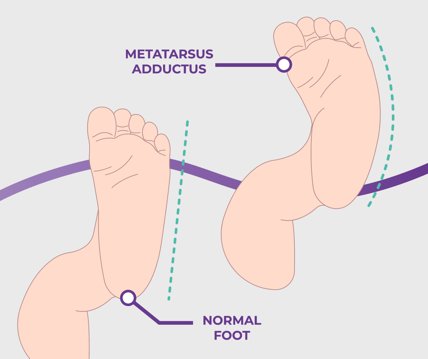 A side view of a foot with a hand holding the ankle. The ankle is highlighted red signifying pain