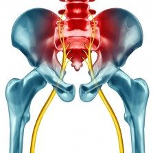 The sciatic nerve that joins into the bones of the pelvis is experiencing sciatica pain