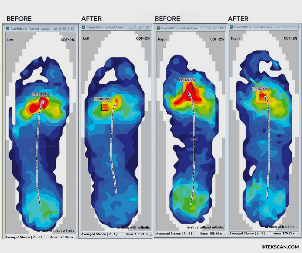 A side view of a foot with a hand holding the ankle. The ankle is highlighted red signifying pain