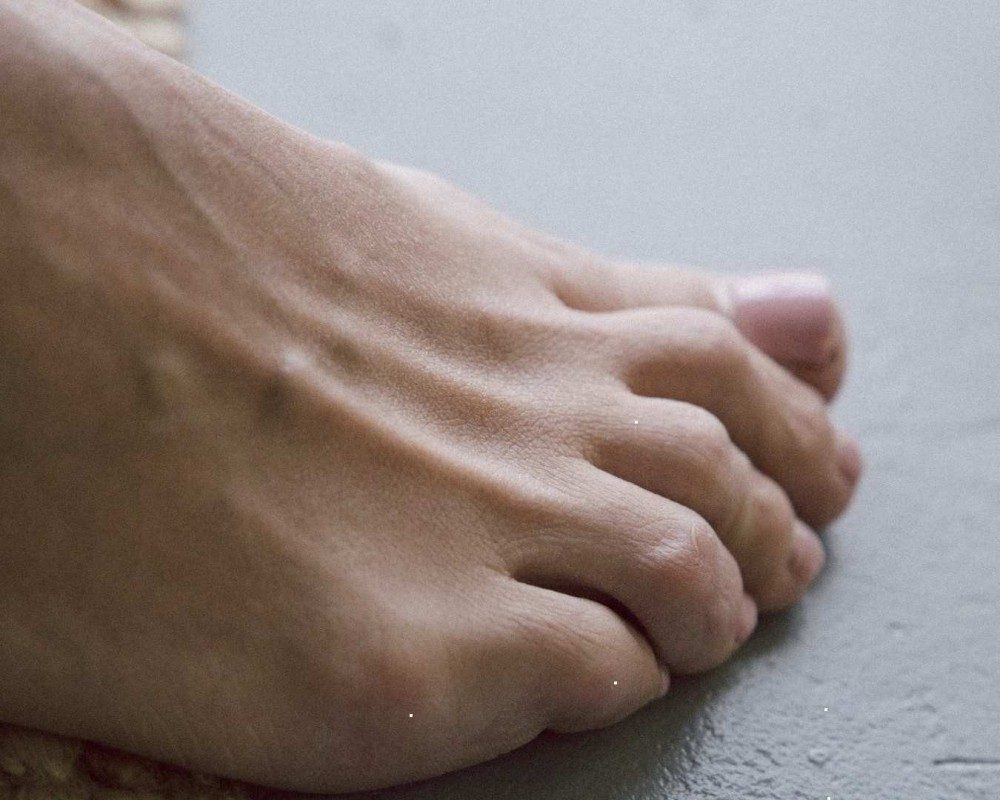 How to cut ingrown toenails